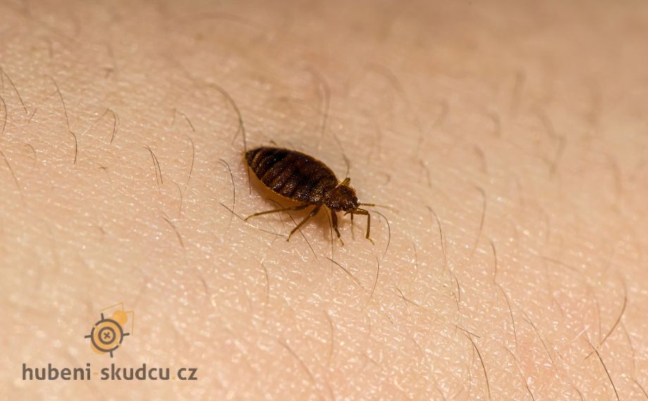 štěnice na ruce